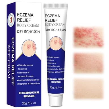 20g Ekzem Creme,Ekzemcreme,Ekzem Anti Juckreiz Creme,Repair creme,Feuchtigkeitscreme,Beruhigt die Haut