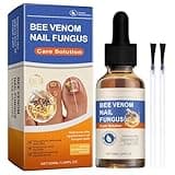 Bienengift Nagelserum, Bienengift NagelverteidigungBehandlungslösung, Nagelpflege Extra Starke Zehennagel-Reparaturflüssigkeit 50 Ml, Vielseitige Nagelreparatur Für Verfärbte Und Beschädigte