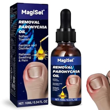 Eingewachsene Zehennägel Behandlung,10ml Fußnägel pflegend,Pflegendes Nagelhautöl, Nail Repair, Feuchtigkeitspflege und Reparatur, Linderung von Schwellungen und Schmerzen